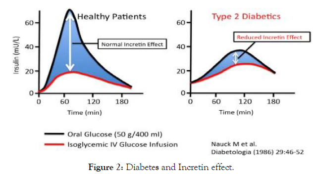 diabetes-metabolism-Diabetes