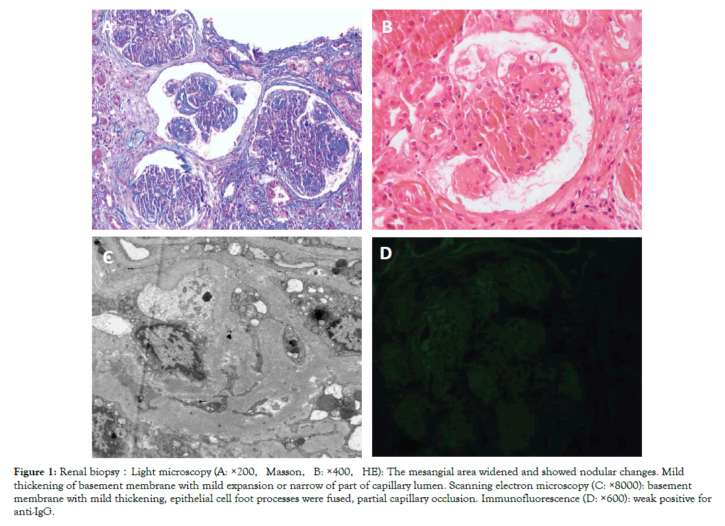 kidney-renal-biopsy