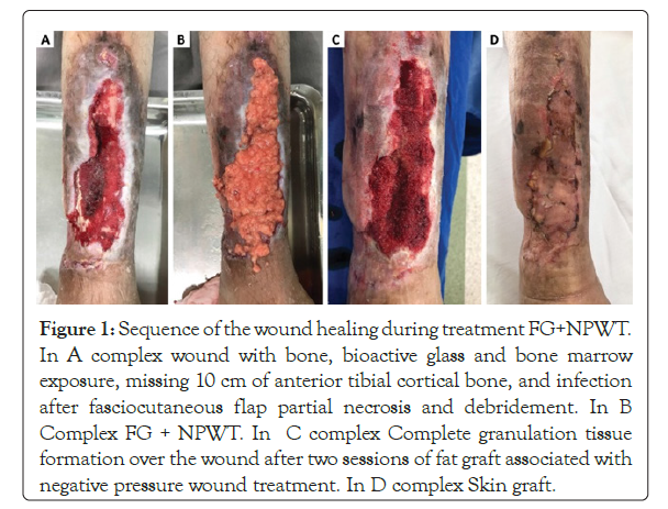 reconstructive-surgery-anaplastology-Sequence