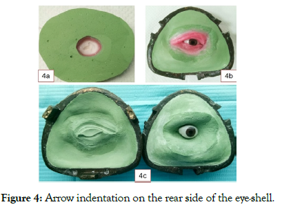 reconstructive-surgery-anaplastology-indentation