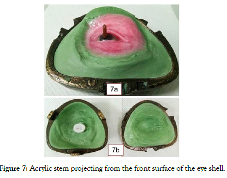 reconstructive-surgery-anaplastology-projecting