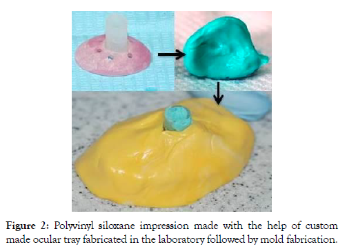 reconstructive-surgery-anaplastology-siloxane