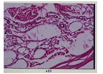 acr-11-5-Anatomy