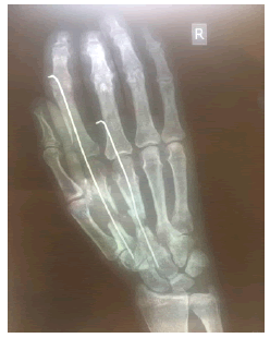 acr-11-5-Preoperative