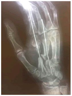 acr-11-5-radiographs