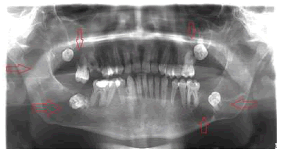 ldacr-11-3-001-g002