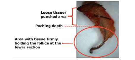 ldacr-11-4-follicle