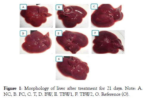 diabetes-metabolism-after-treatment