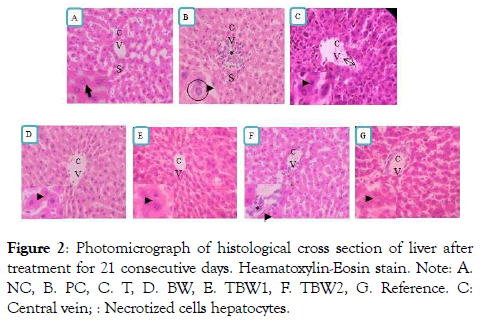 diabetes-metabolism-cross-section