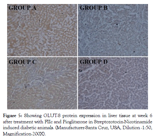 diabetes-metabolism-liver-tissue