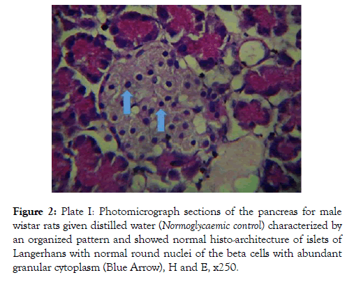 diabetes-metabolism-pancreas