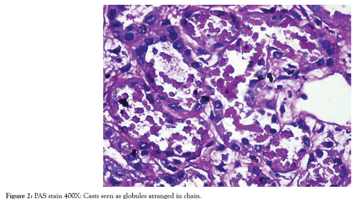 kidney-globules-arranged-chain