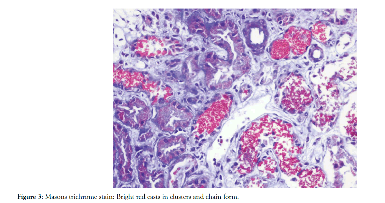 kidney-globules-arranged-chain