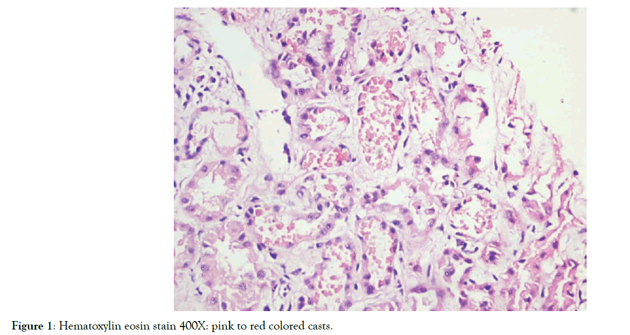 kidney-hematoxylin-eosin