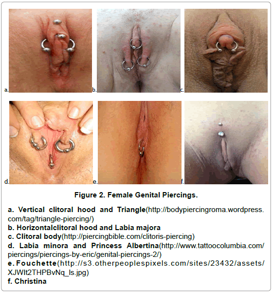 anaplastology-female-genital-piercings