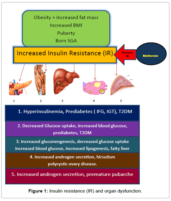 diabetes-metabolism-Insulin-resistance