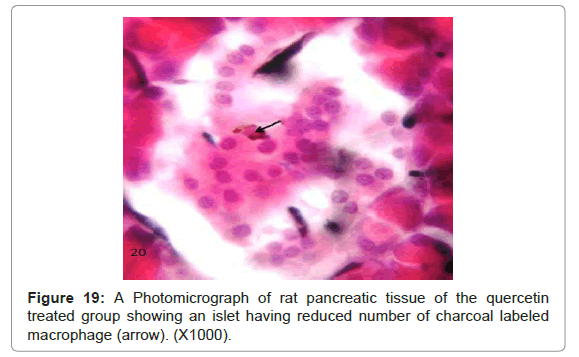 diabetes-metabolism-Photomicrograph-rat-pancreatic