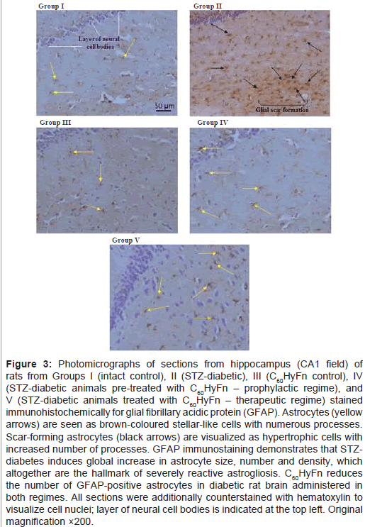 diabetes-metabolism-Photomicrographs-sections-hippocampus