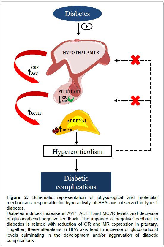 diabetes-metabolism-Schematic-representation